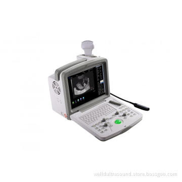 Digital Ultrasound Scanner
